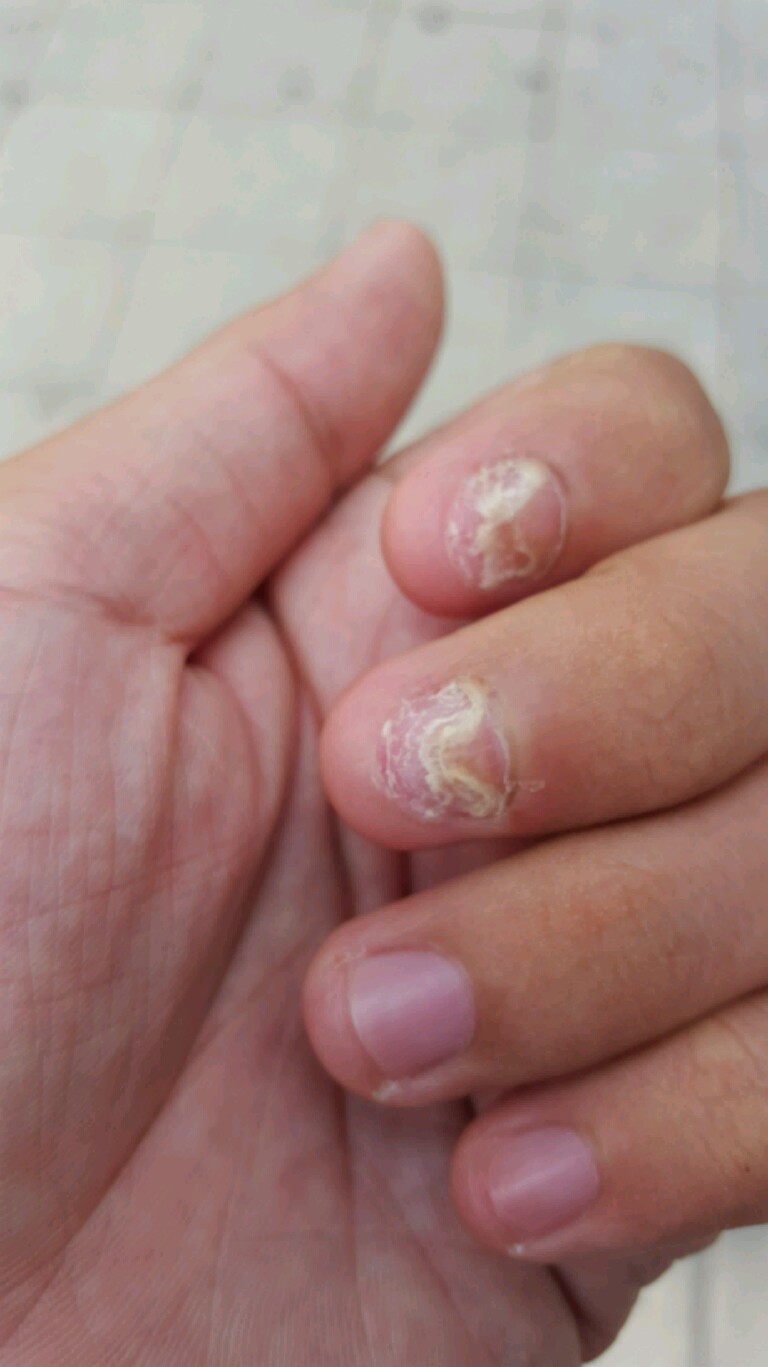 เล็บมือ