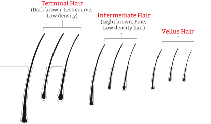 Propecia Vellus Hair