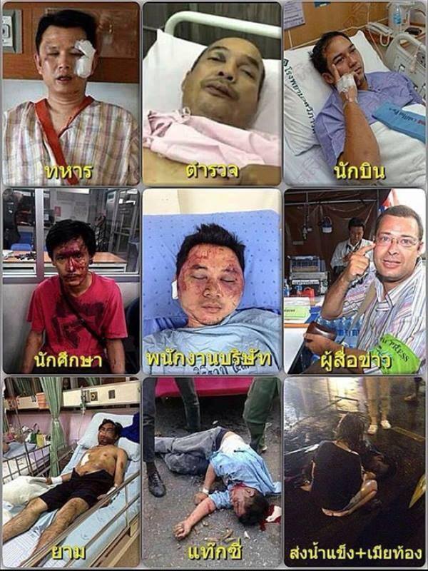 รูปภาพ