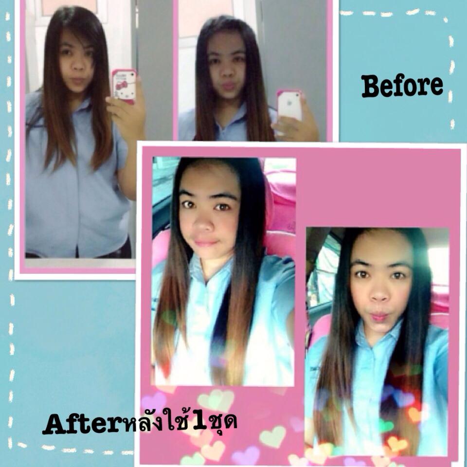 My Image 33