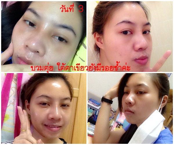 à¸£ à¸§ à¸§à¹€à¸ªà¸£ à¸¡à¸ˆà¸¡ à¸à¸ à¸šà¸«à¸¡à¸­à¸š à¸à¸– à¸™ à¸š à¸à¸¢à¸£ à¸•à¸™ à¸„à¸¥ à¸™ à¸„ à¸„à¸£ à¸² Pantip