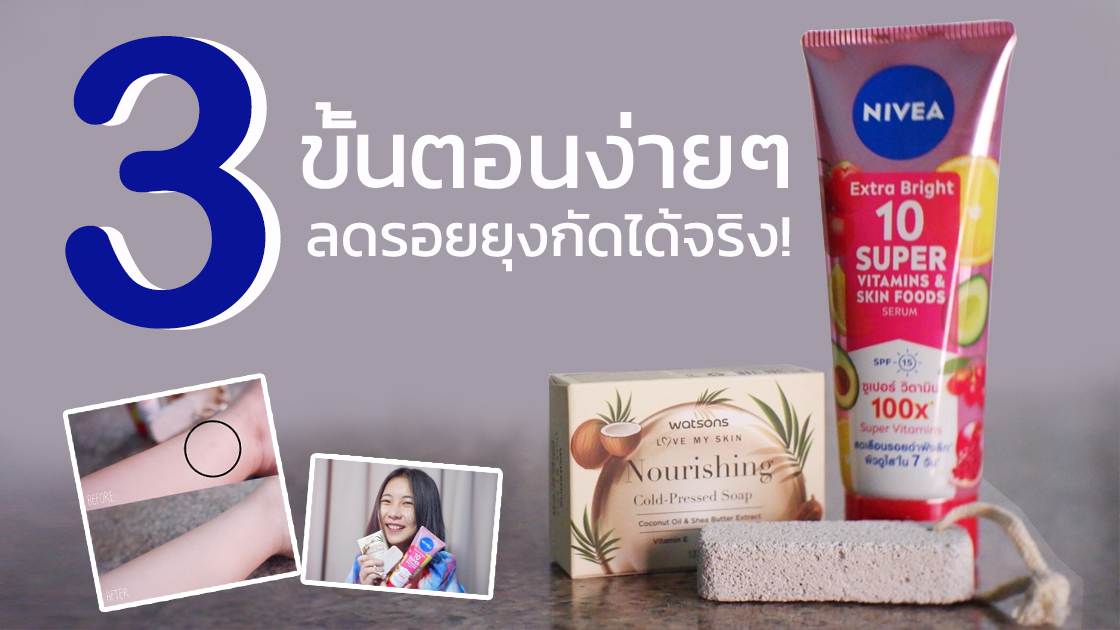 3 ขั้นตอนง่ายๆ วิธีแก้ขาลายจากรอยยุงกัด - Pantip