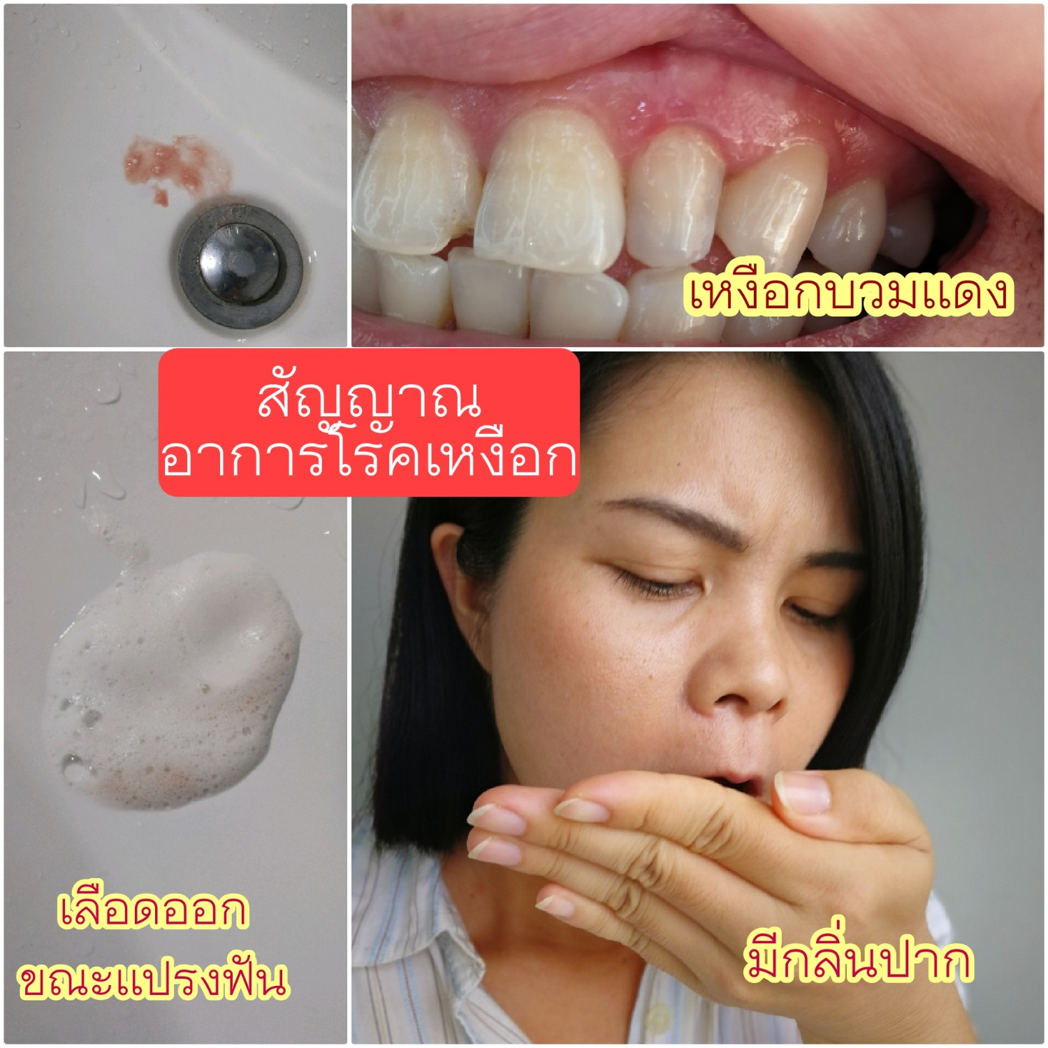 รีวิว ยาสีฟันพาโรดอนแท กซ์ เฮอร์ บัล เฟรช ยาสีฟันช่วยลดเลือดออกขณะแปรง ...