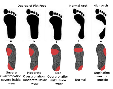 ขอคำแนะนำรองเท้าวิ่งสำหรับคนเท้าแบน (Flat) หน้าเท้ากว้าง - - - - - - Pantip