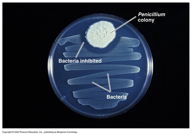 ☆☆☆ซีรีส์พาไป :: ตอน เพนิซิลิน (Penicillin) ยาปฏิชีวนะตัวแรกของโลก !!!☆