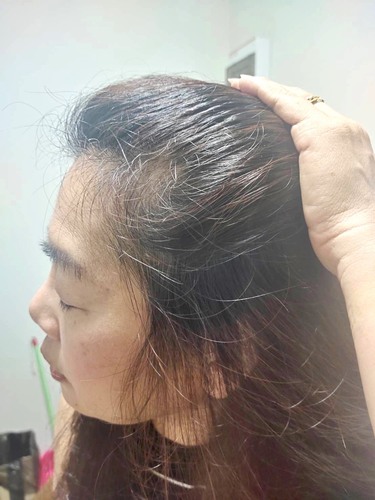 แชร์ประสบการณ์ปิดผมหงอกในวัย 50 ด้วยแคร์บิว ผมไม่เสีย ทำเองง่ายๆ ไม่ง้อร้าน - Pantip แชร์ประสบการณ์ปิดผมหงอกในวัย 50 ด้วยแคร์บิว ผมไม่เสีย ทำเองง่ายๆ ไม่ง้อร้าน - Pantip