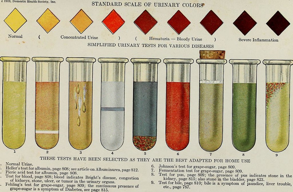 the-wheel-of-urine-pantip