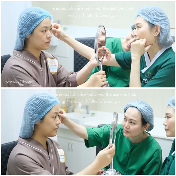 รีวิว ทำตาสองชั้น Lovely Eye And Skin Clinic (ทีมแพทย์หมอรวงข้าว) - Pantip