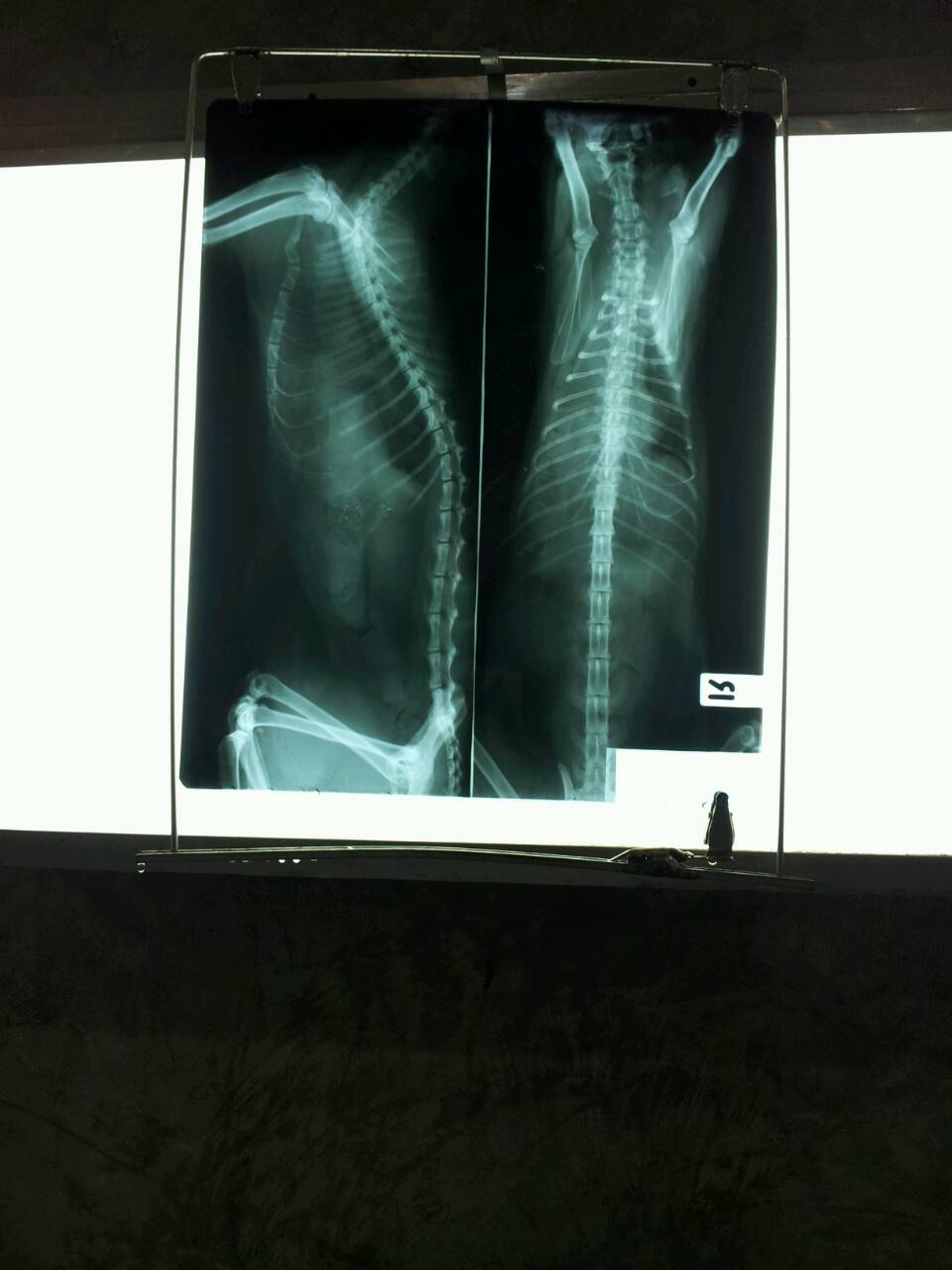 x ray ปอด โควิด ราคา