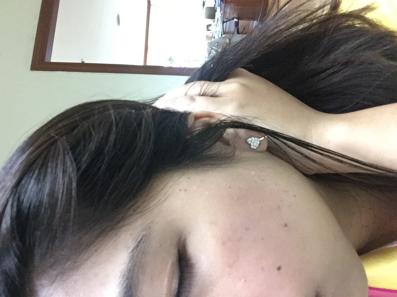 รีวิวประสบการณ์ครั้งแรกกับการจี้กระเนื้อ/ติ้งเนื้อค่ะ - Pantip รีวิวประสบการณ์ครั้งแรกกับการจี้กระเนื้อ/ติ้งเนื้อค่ะ - Pantip