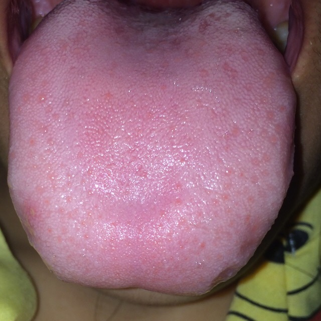 My Image 15