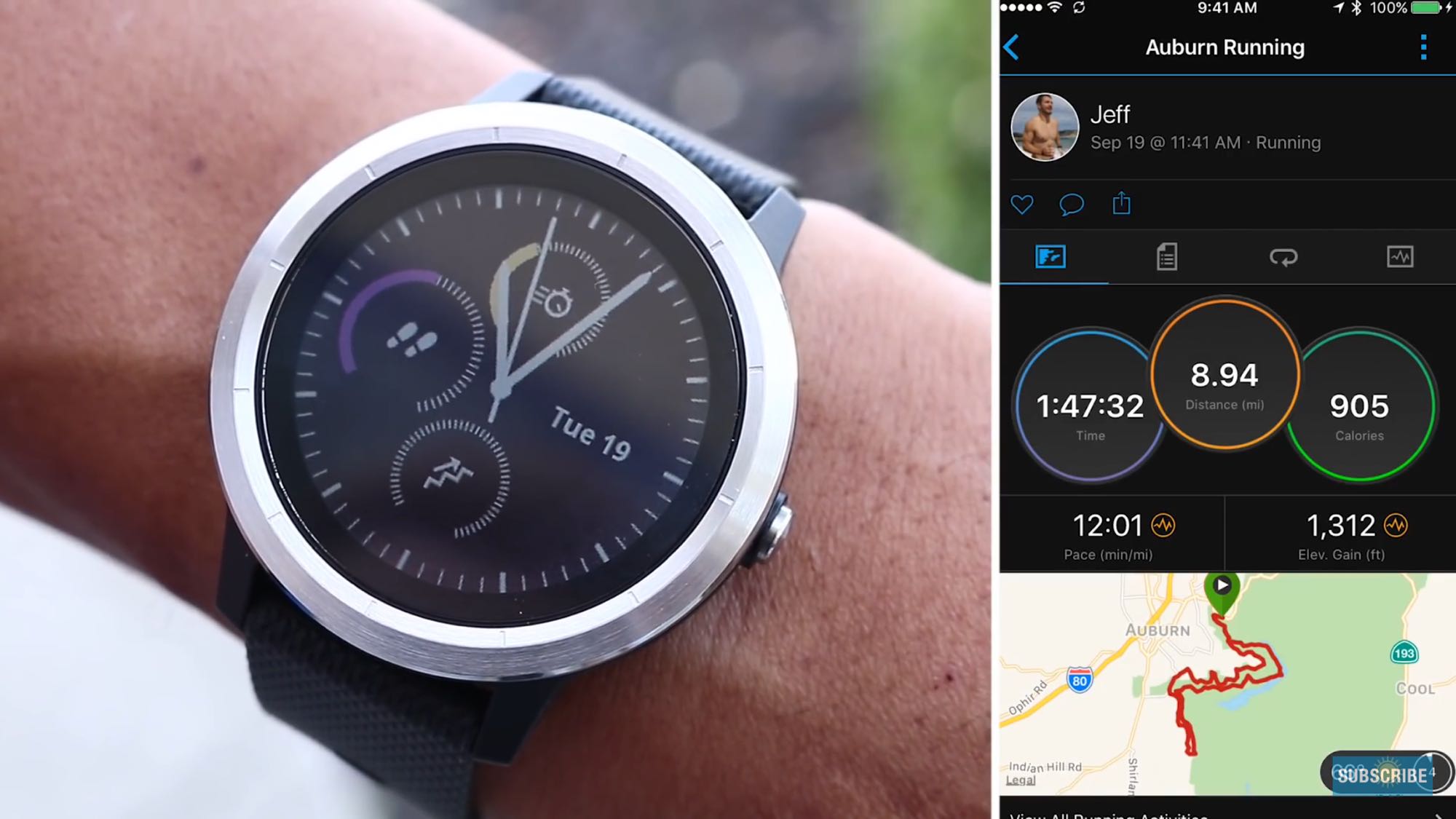 smart watch xiaomi pantip