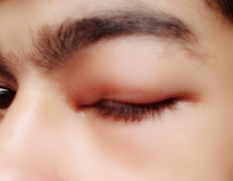 ตากุ้งยิง