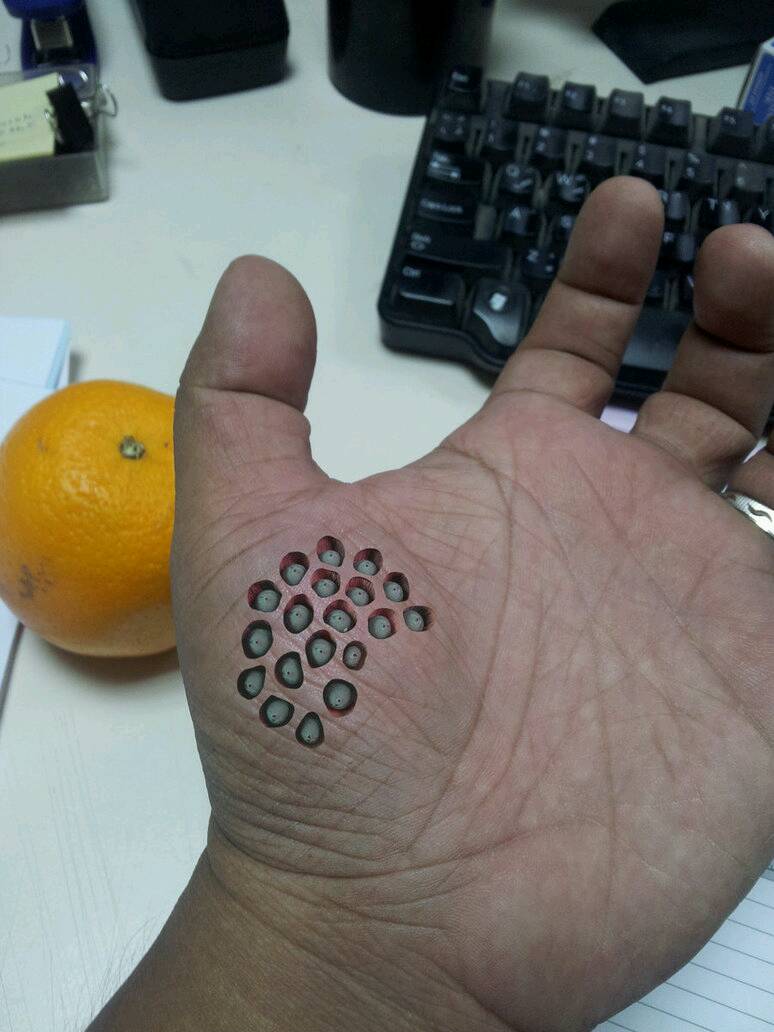 trypophobia-pantip