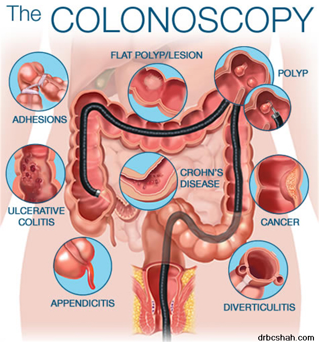  CR PR Patient Review colonoscopy 