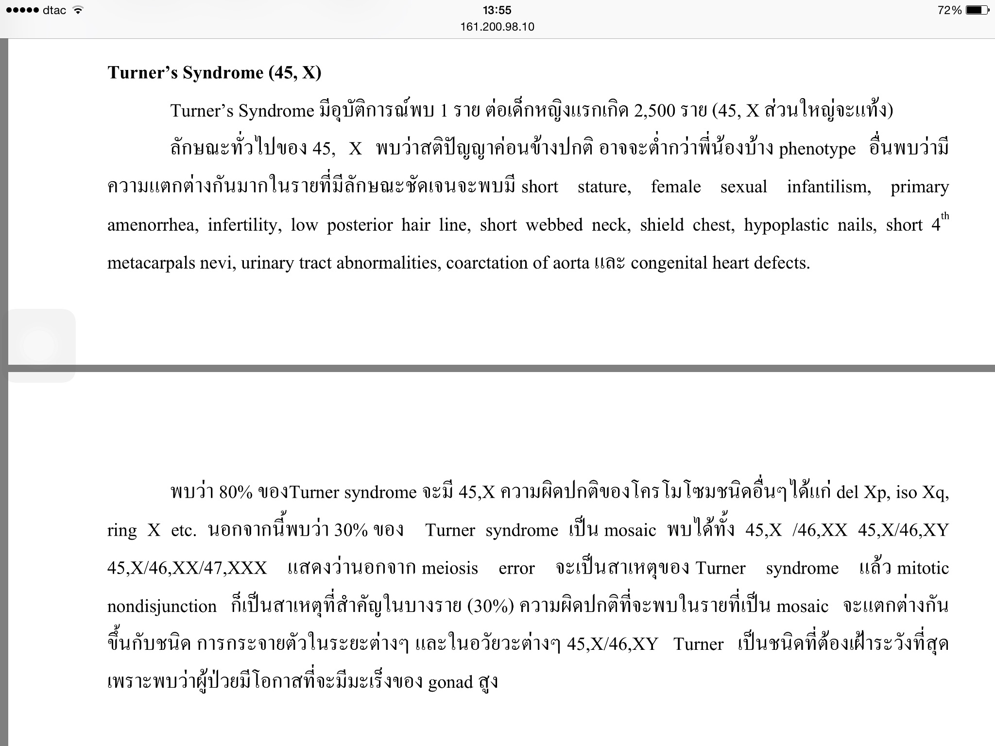อยากร จ กอาการของ Musaic Turner Syndrome ขอความกร ณาท านท ม ความ