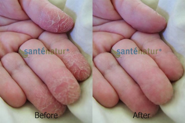 Santenatur, Potato Cream Skin Hand & Feets, ครีมมันฝรั่งบำรุงผิว มือ เท้า
