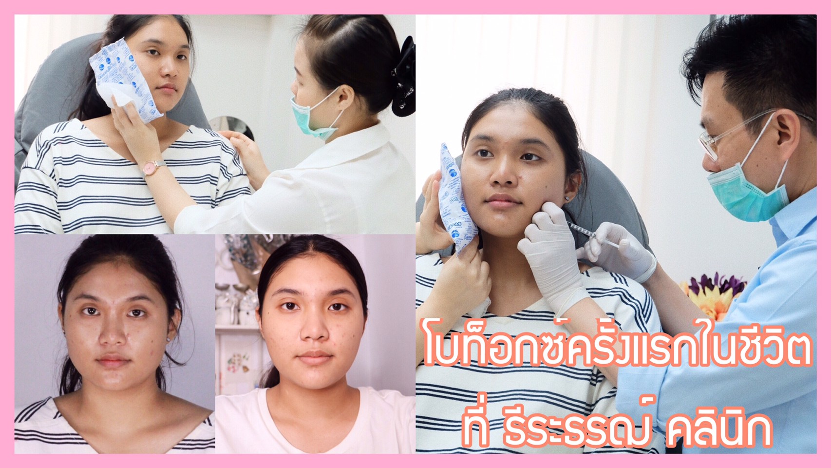 Review : ฉีด Botox ลดกรามครั้งแรกที่ ธีระธรฌ์คลินิก | Lenalena Makeup | -  Pantip